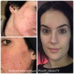 photo - Schoonheidsinstituut PUUR | BEAUTY