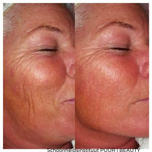 photo - Schoonheidsinstituut PUUR | BEAUTY