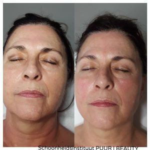 photo - Schoonheidsinstituut PUUR | BEAUTY