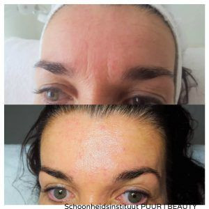 photo - Schoonheidsinstituut PUUR | BEAUTY